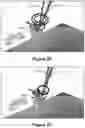 Fig. 23 - Augmented reality headset with varied opacity for navigated robotic surgery