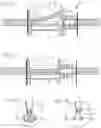 Fig. 09 - Compression belt assembly for a chest compression device
