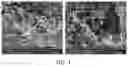 Fig. 02 - MEDICAL FILLER COMPOSITION