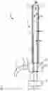 Fig. 02 - CANNULAS AND CANNULA ASSEMBLIES FOR HEMODIALYSIS