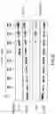 Fig. 14 - ALLOGENEIC T-CELLS AND METHODS FOR PRODUCTION THEREOF