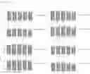 Fig. 13 - Peptide Nucleic Acid Complex Having Endosomal Escape Capacity, And Use Thereof