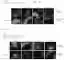 Fig. 19 - Peptide Nucleic Acid Complex Having Endosomal Escape Capacity, And Use Thereof