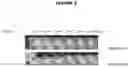 Fig. 04 - BACTERIA IDENTIFICATION AND ANTIMICROBIAL SUSCEPTIBILITY TEST