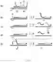 Fig. 23 - Enzyme method