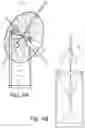 Fig. 05 - Tensioned Support Ring for Wind and Water Turbines