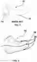 Fig. 02 - In-ear and around-the-ear electroencephalography system with floating electrodes and method thereof