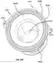 Fig. 07 - Natural orifice surgery system