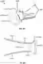 Fig. 18 - Natural orifice surgery system