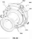 Fig. 26 - Natural orifice surgery system