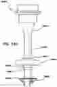Fig. 41 - Natural orifice surgery system