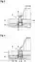 Fig. 04 - Prosthetic Component