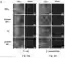 Fig. 07 - Antibacterial coating or surface comprising vertical, standing angstrom scale flakes