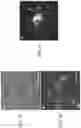 Fig. 07 - SYSTEM AND METHODS FOR OPTOGENETIC EVALUATION OF HUMAN NEUROMUSCULAR FUNCTION