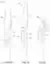 Fig. 04 - HIDDEN FASTENER TO SECURE LOOSE VINYL SIDING