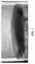 Fig. 02 - Method for simulating intraplate volcanism