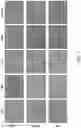 Fig. 09 - MEDICAL DEVICE COMPRISING GRAPHENE COATING