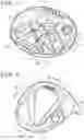 Fig. 07 - GOLF CLUB HEAD