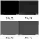 Fig. 09 - PLATELET DIAGNOSTIC IMAGING AGENTS