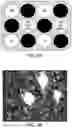 Fig. 11 - PLATELET DIAGNOSTIC IMAGING AGENTS
