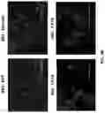 Fig. 08 - PROCESS FOR MAKING CELL POPULATIONS OF THE HEPATIC LINEAGE FROM ENDODERMAL CELLS AND CELLULAR COMPOSITIONS COMPRISING SAME
