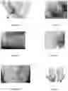 Fig. 02 - Method for evaluating the efficacy of a composition in reducing the effects of cancer therapeutics on skin