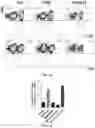 Fig. 12 - Methods of obtaining tumor-specific T cell receptors