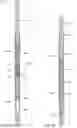Fig. 09 - Downhole casing pulling tool