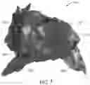 Fig. 04 - Automatic demarcation of anatomical structures