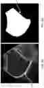 Fig. 07 - Apparatus and method for image segmentation using a deep convolutional neural network with a nested U-structure