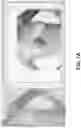 Fig. 08 - Marker-less augmented reality system for mammoplasty pre-visualization