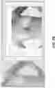 Fig. 09 - Marker-less augmented reality system for mammoplasty pre-visualization