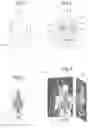 Fig. 03 - Method for producing a digital representation for producing an appliance for a living body and corresponding device