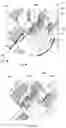 Fig. 08 - Handling medication receptacles by pharmaceutical dispensing system and method