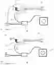 Fig. 02 - Vibrato arm and system