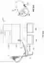 Fig. 197 - Fluid distribution device for a multiple viewing elements endoscope