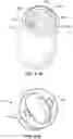 Fig. 61 - FOCUSED STERILIZATION AND STERILIZED SUB-ASSEMBLIES FOR ANALYTE MONITORING SYSTEMS