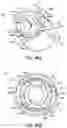 Fig. 89 - FOCUSED STERILIZATION AND STERILIZED SUB-ASSEMBLIES FOR ANALYTE MONITORING SYSTEMS