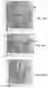 Fig. 49 - Methods and devices for applying energy to bodily tissues