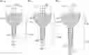 Fig. 01 - IMPLANT DENTISTRY METHODS AND APPARATUSES