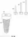 Fig. 11 - IMPLANT DENTISTRY METHODS AND APPARATUSES