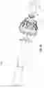 Fig. 20 - Prosthesis, delivery device and methods of use