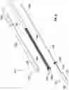 Fig. 30 - Prosthesis, delivery device and methods of use