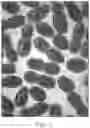 Fig. 02 - METHODS FOR SUPPORTING WEIGHT LOSS AND WEIGHT LOSS MAINTENANCE BY ADMINISTRATION OF AQUATIC PLANTS AND/OR AUTOLOGOUS MICROBIOME SAMPLES