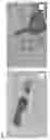 Fig. 02 - METHOD FOR THE TREATMENT OF HYPOXIC-ISCHEMIC ENCEPHALOPATHY IN NEWBORNS