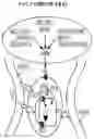 Fig. 02 - METHODS AND DEVICES FOR INHIBITING NERVES WHEN ACTIVATING BROWN ADIPOSE TISSUE