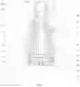 Fig. 02 - Atomizer and electronic cigarette with an air input amount adjustable by rotating a mouthpiece