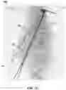 Fig. 02 - HAIR SETTING TOOL