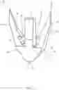 Fig. 02 - Trocar site closure clip