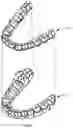 Fig. 02 - Multilayer dental appliances and related methods and systems